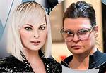 Linda Evangelista Admits She Still Gets Botox After Being ‘Brutally Disfigured’ by Coolsculpting Procedure