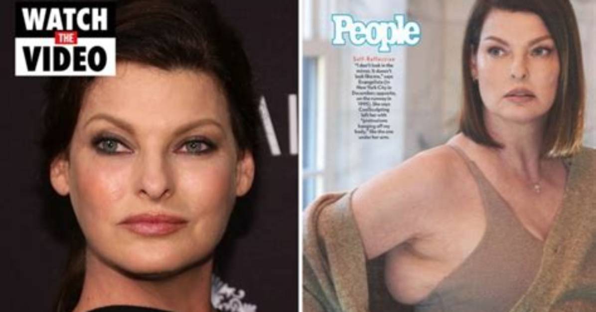 Linda Evangelista Reveals How Her Botched Fat-Freezing Procedure Changed Relationship with Son