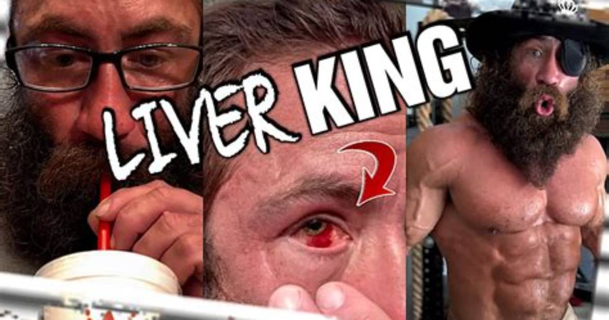 Liver King Eye Injury: What Happened to His Eye?