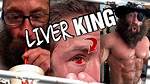 Liver King Eye Injury: What Happened to His Eye?