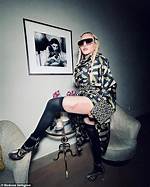 Madonna Reveals Massive Bruise Down Her Entire Thigh While Rocking Versace in New Photos
