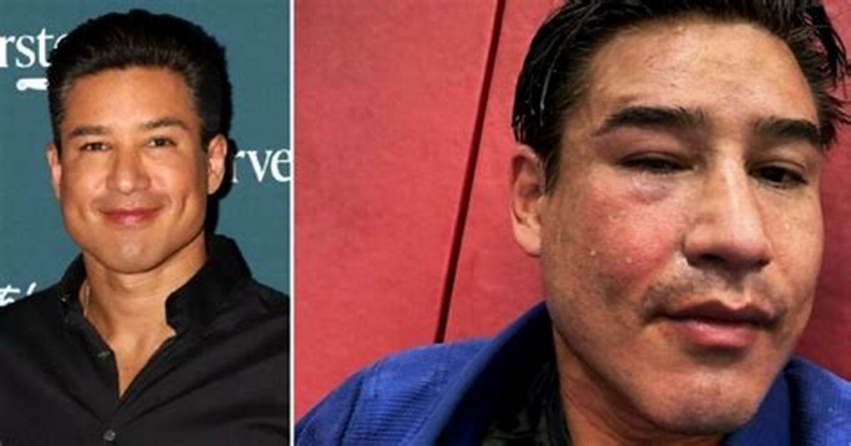 Mario Lopez Controversies: Unraveling the Enigma