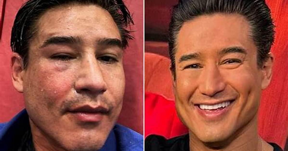 Mario Lopez Sports a Black Eye in Photo Taken After Jjiujutsu Session – Hollywood Life