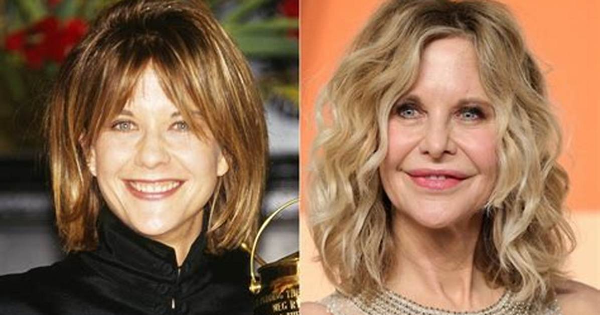 Meg Ryan’s Face Timeline — Pics