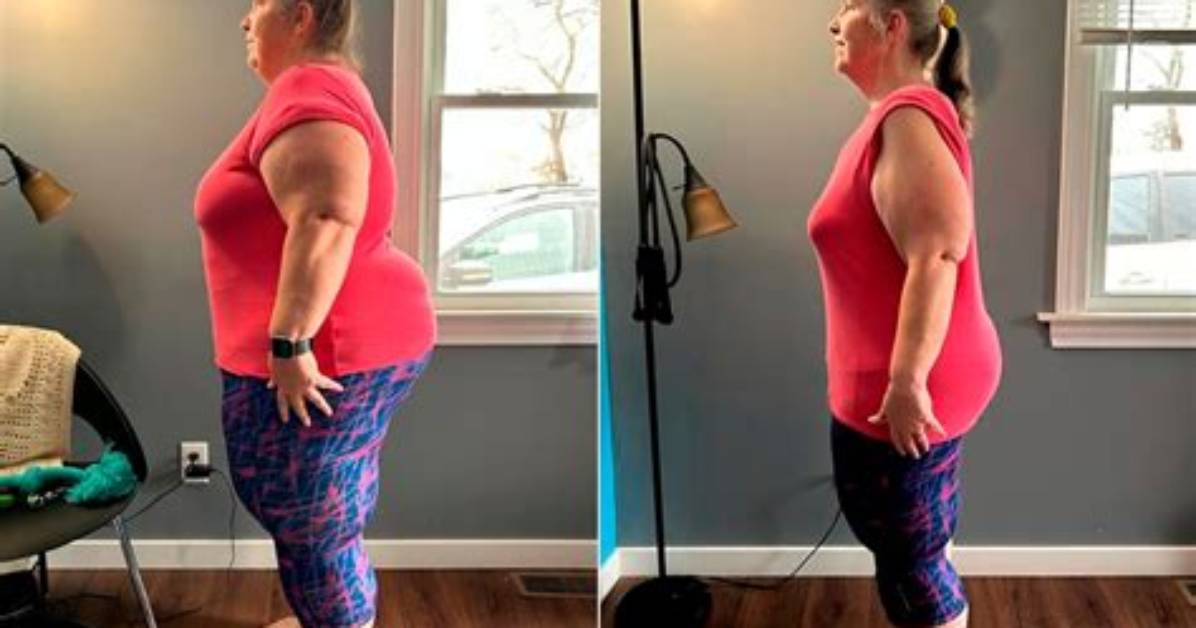 Meredith Duxbury Weight Loss Journey: Before and After Photos