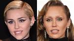 Miley Cyrus Buccal Fat Removal: Before and After Photos