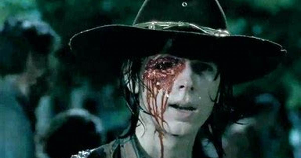 [Pic] Carl’s Eye Socket on ‘The Walking Dead’ — See What’s Under His Eye Patch – Hollywood Life