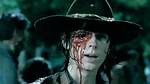 [Pic] Carl’s Eye Socket on ‘The Walking Dead’ — See What’s Under His Eye Patch – Hollywood Life