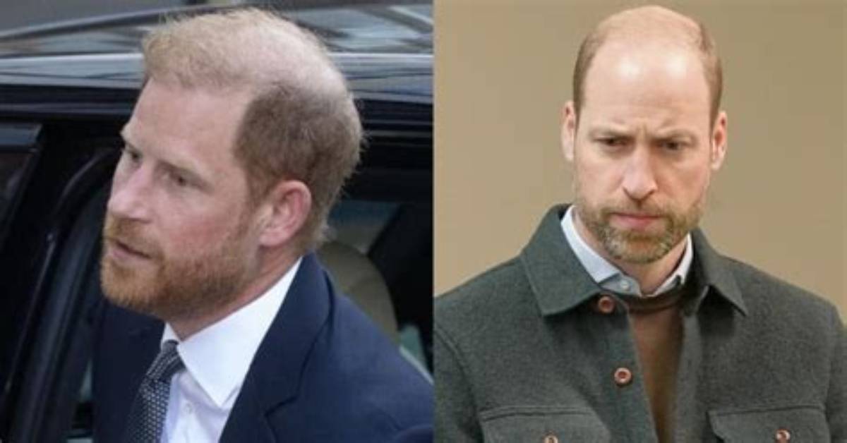 Prince Harry Mocks Williams’ ‘Alarming’ Hair Loss in Memoir, ‘Spare’ – Hollywood Life