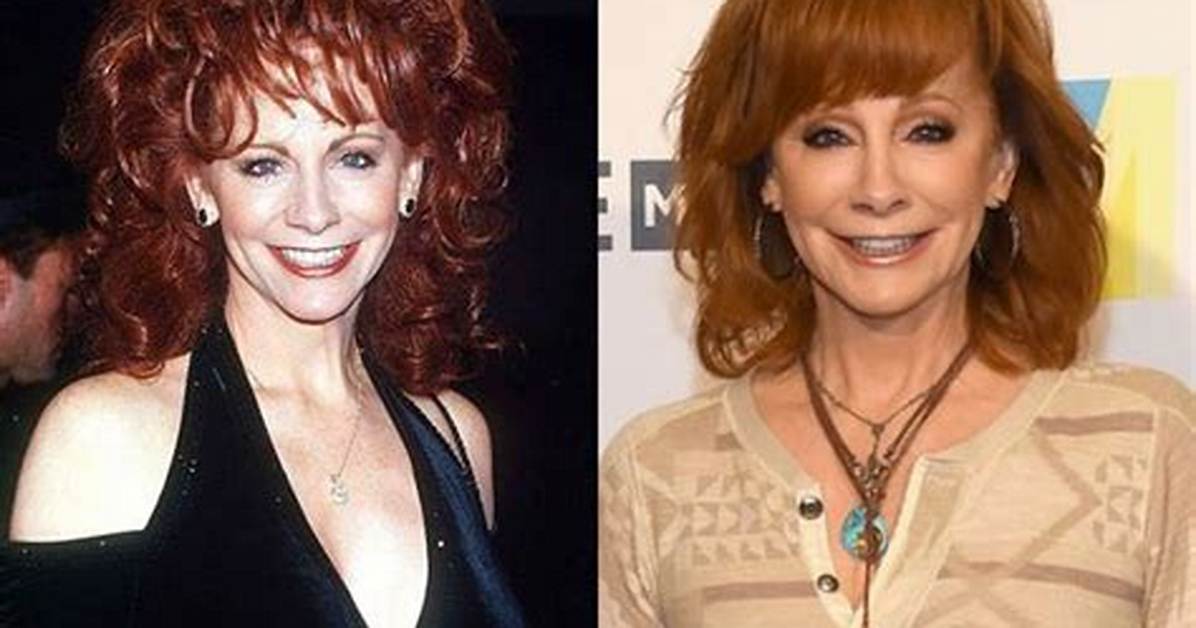 Reba Mcentire Plastic Surgery: Before and After Photo