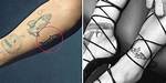 Rihanna Appears to Replace Drake Shark Tattoo in New Photo – Hollywood Life