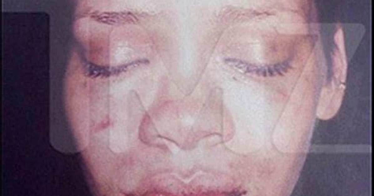 Rihanna Attacked over Chris Brown Relationship — Left Bleeding