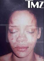 Rihanna Attacked over Chris Brown Relationship — Left Bleeding