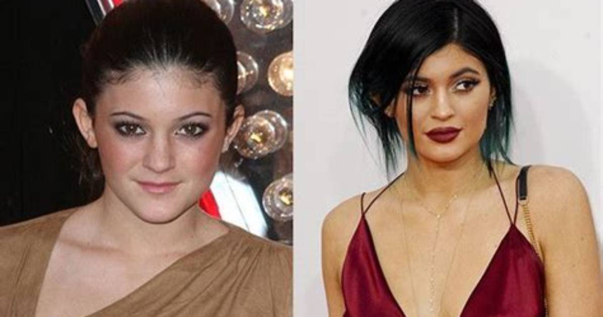 See Before & After Pics of Kylie Jenner & More – Hollywood Life