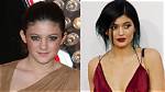 See Before & After Pics of Kylie Jenner & More – Hollywood Life