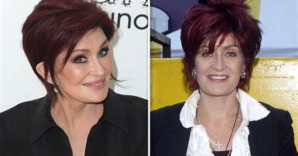 Sharon Osbourne Opens up About Botched Facelift: ‘It Was Wicked’