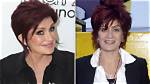 Sharon Osbourne Opens up About Botched Facelift: ‘It Was Wicked’