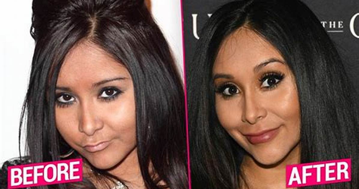 Snooki Reveals Plastic Surgery & Lips Filming ‘Jersey Shore’ Reboot – Hollywood Life