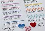 Stitches