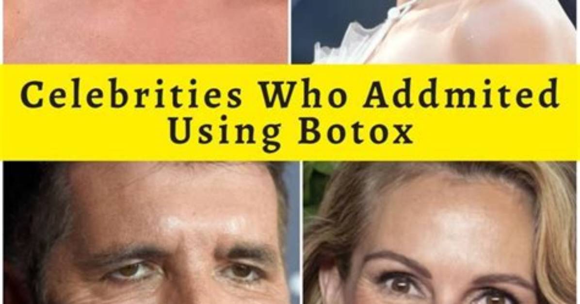 The Botox Craze in Hollywood: Celebrities Embracing the Fountain of Youth
