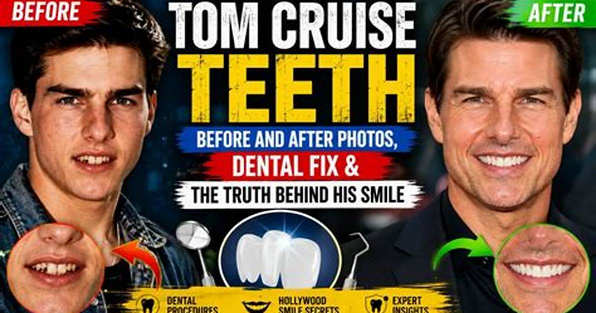 The Shocking Truth: Tom Cruise's Dental Disasters