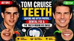 The Shocking Truth: Tom Cruise's Dental Disasters