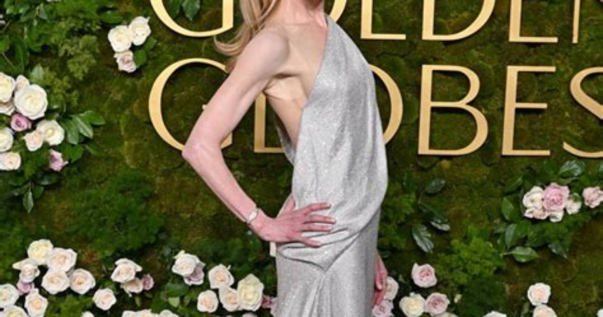 The Startling Transformation: Nicole Kidman's Weight Gain Journey