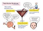 The Surprising Truth About Fetal Alcohol Syndrome and Celebrities