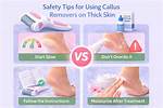 This Wildly Popular Callus Remover Is So Effective You’ll Be a ‘Smooth Criminal’ in No Time