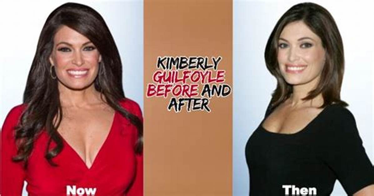 Transformations of Kimberly Guifoyle: a Deep Dive into Her Journey