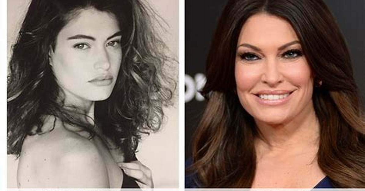 Transformative Journey: Kimberly Guilfoyle Before and After Pictures