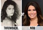 Transformative Journey: Kimberly Guilfoyle Before and After Pictures