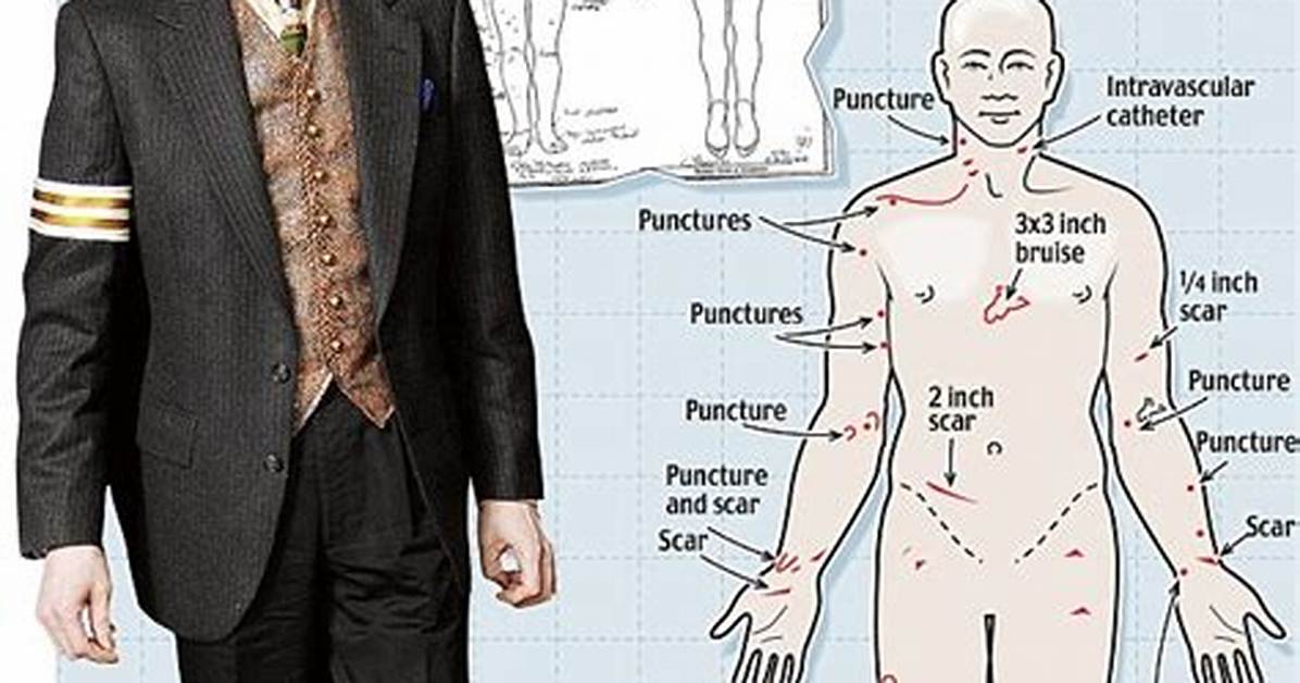 Unveiling the Truth: Michael Jackson Autopsy Results