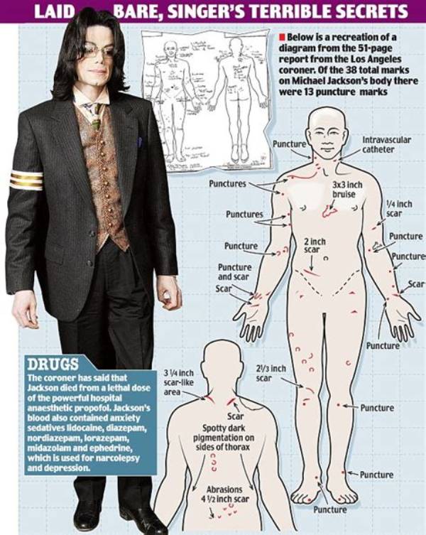 Unveiling the Truth: Michael Jackson Autopsy Results