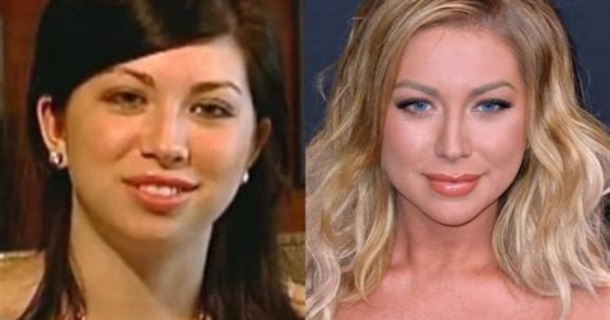 ‘Vanderpump Rules’ Star Reveals More Plastic Surgery – Hollywood Life