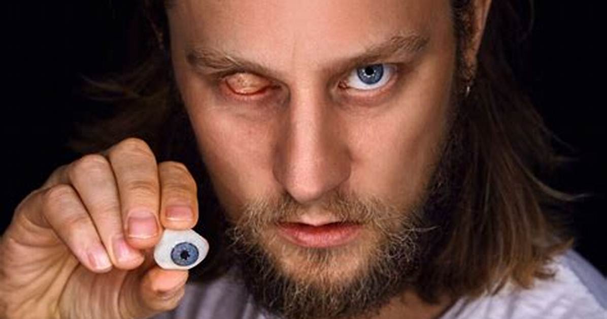 What Happened to Tadhg Murphy Eye? Conversations with Friends Actor Is Blind on His Right Eye
