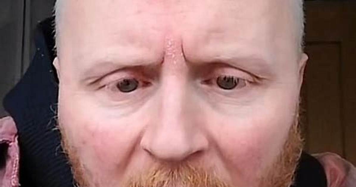 Who Is Paul Breach Aka Beautybeyondthe_Eye on Tiktok? All We Know About the Tiktok Star